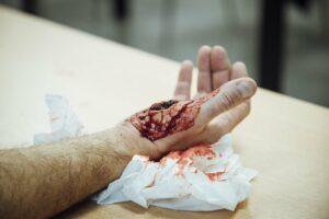 Une main blessée qui saigne